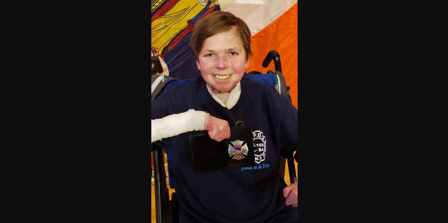 Where is John Hudson Dilgen Now? Update on the Body Bizarre Star